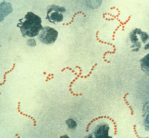 beta-hemloytic strep